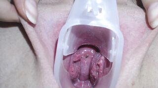 能清晰的看到子宫